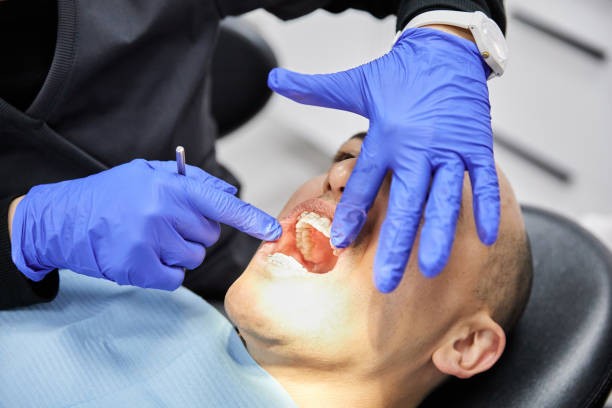 Best Emergency Tooth Extraction in Martin, SD