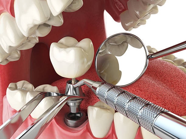 Best Emergency Treatment for Dental Infections or Abscesses in Martin, SD